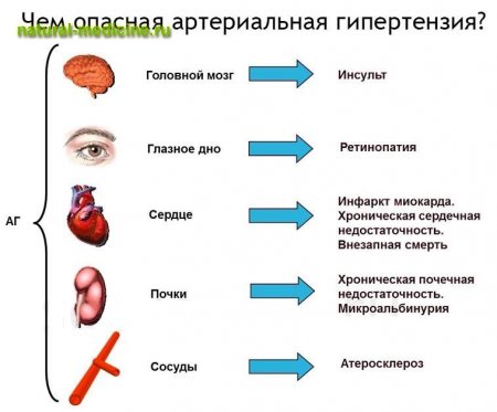 guska u glavu u hipertenzije)