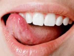 Plutni jezik i usne. Ako snažno opekoti jezik.